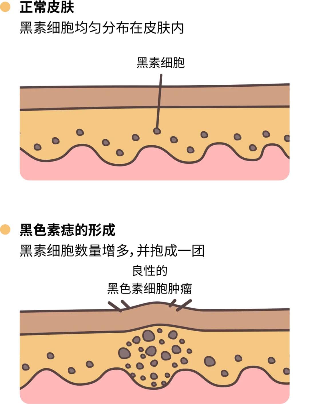 皮肤上突然冒出的小黑点，到底是啥啊?