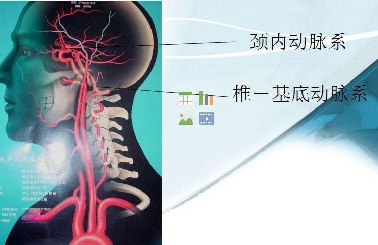 影像技术 | 一文读懂颅脑CTA检查技术