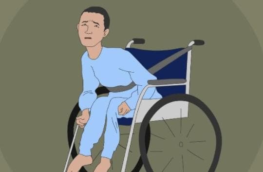 人参、黄芪助力肌营养不良治疗，但需专业指导