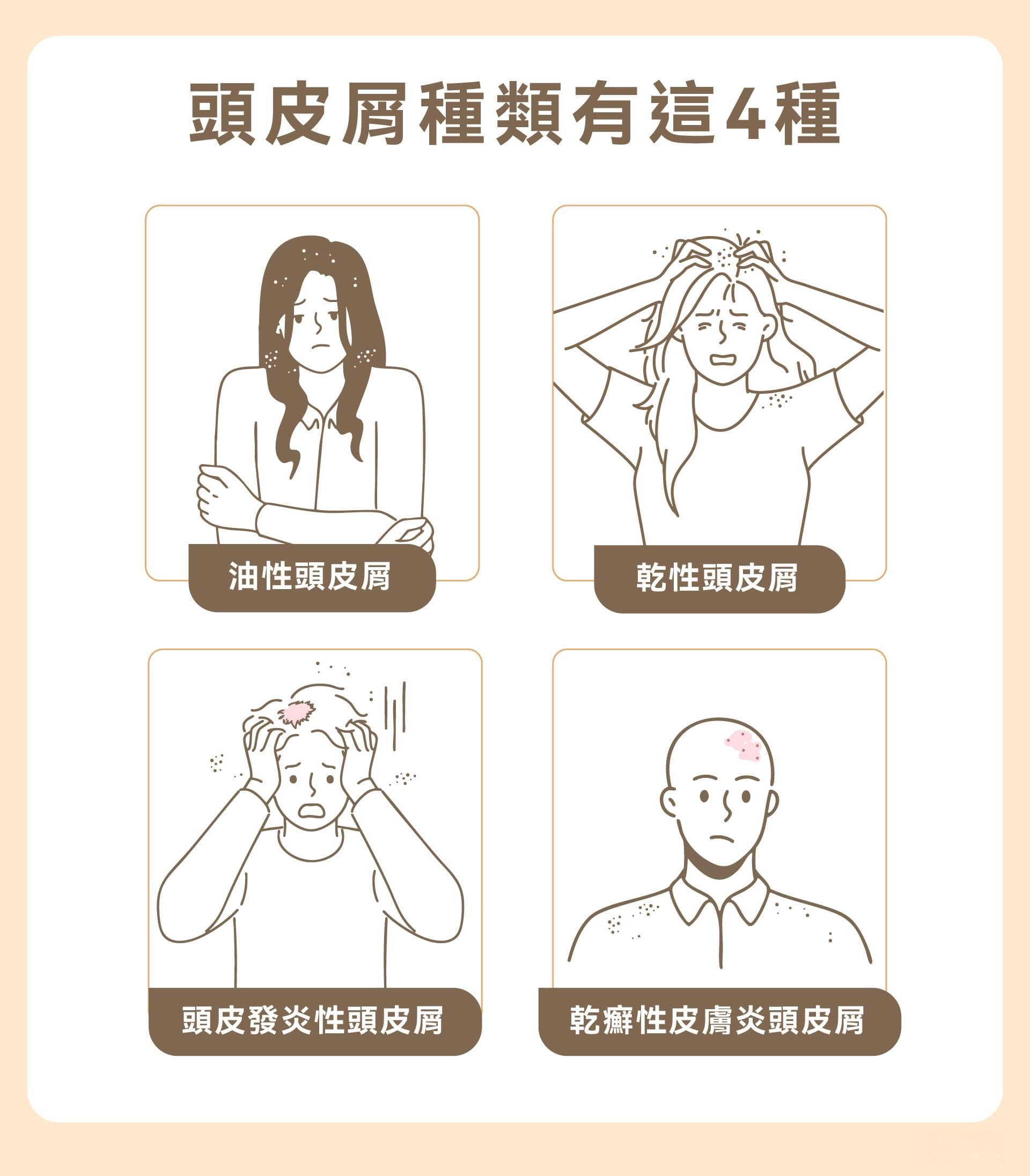 头皮屑一直掉？一次了解6大原因、5招解决方法，帮助改善头皮屑