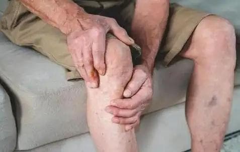 体内有癌，“腿”先知？提醒：若腿部有4个异常，需尽早做筛查