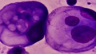 长春生物新冠疫苗和北京生物是一家吗？长春生物新冠疫苗怎么样