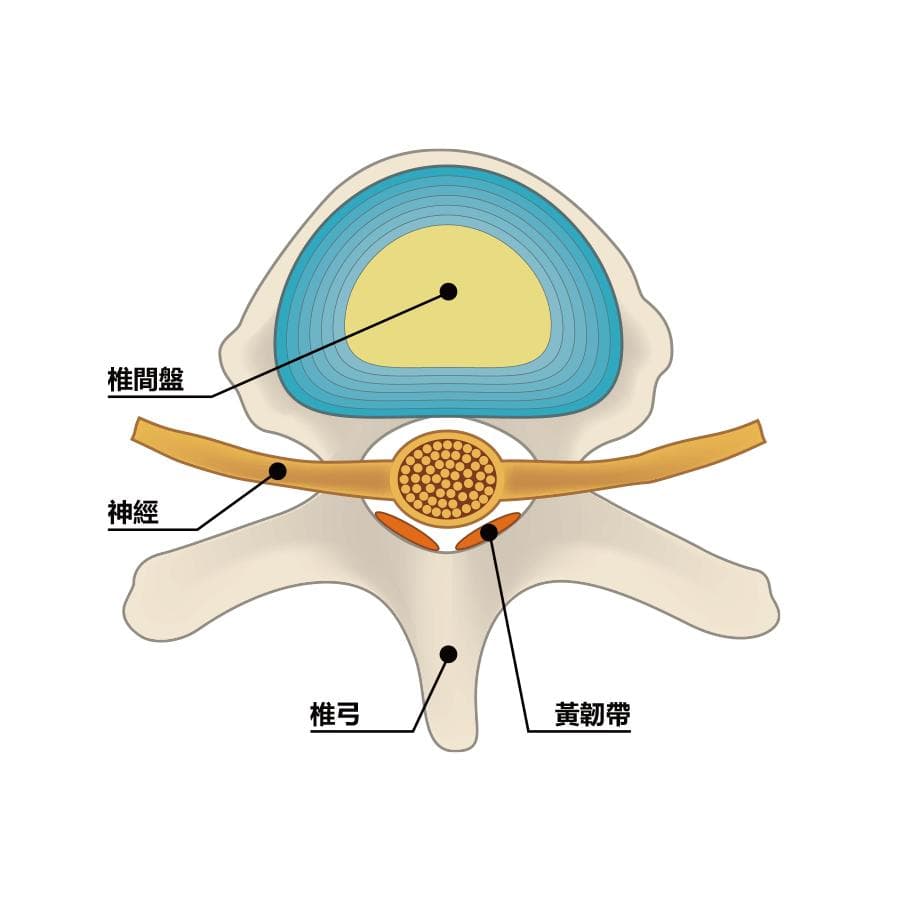 腰椎管狭窄的治疗方法和适应症