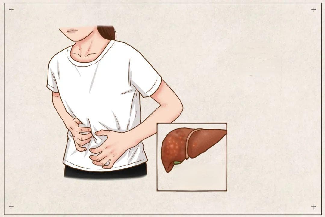 肝好不好，有经验的医生看手掌可能就知道