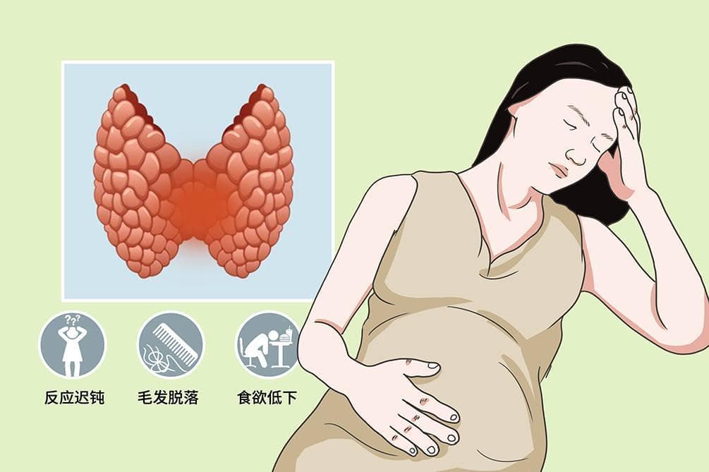 孕妇注意！甲状腺功能减退可能影响胎儿健康！