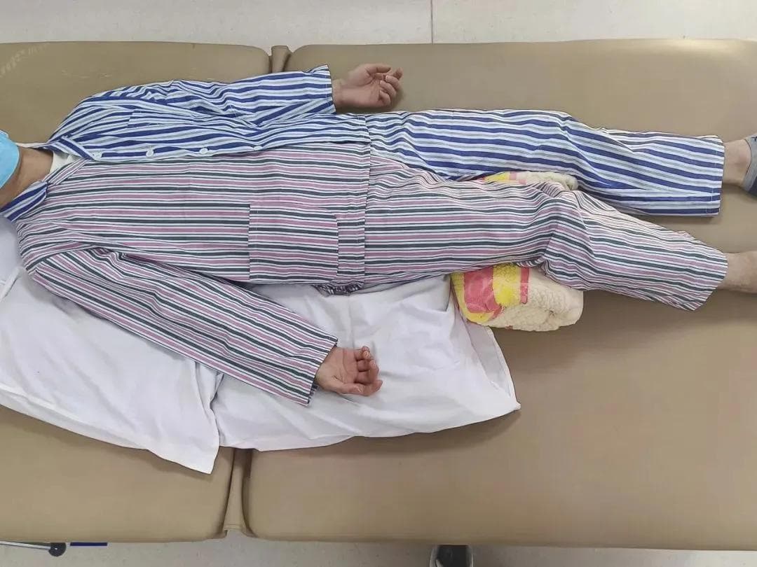 关于“中风”，那些你以为的就是对的吗？