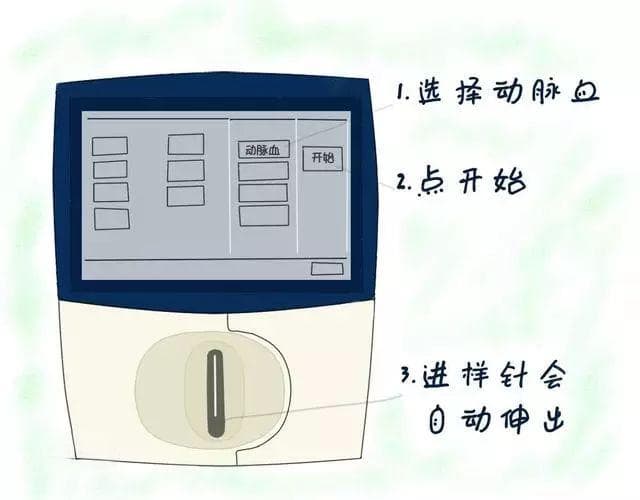 看完这篇，血气分析再也难不倒你了！