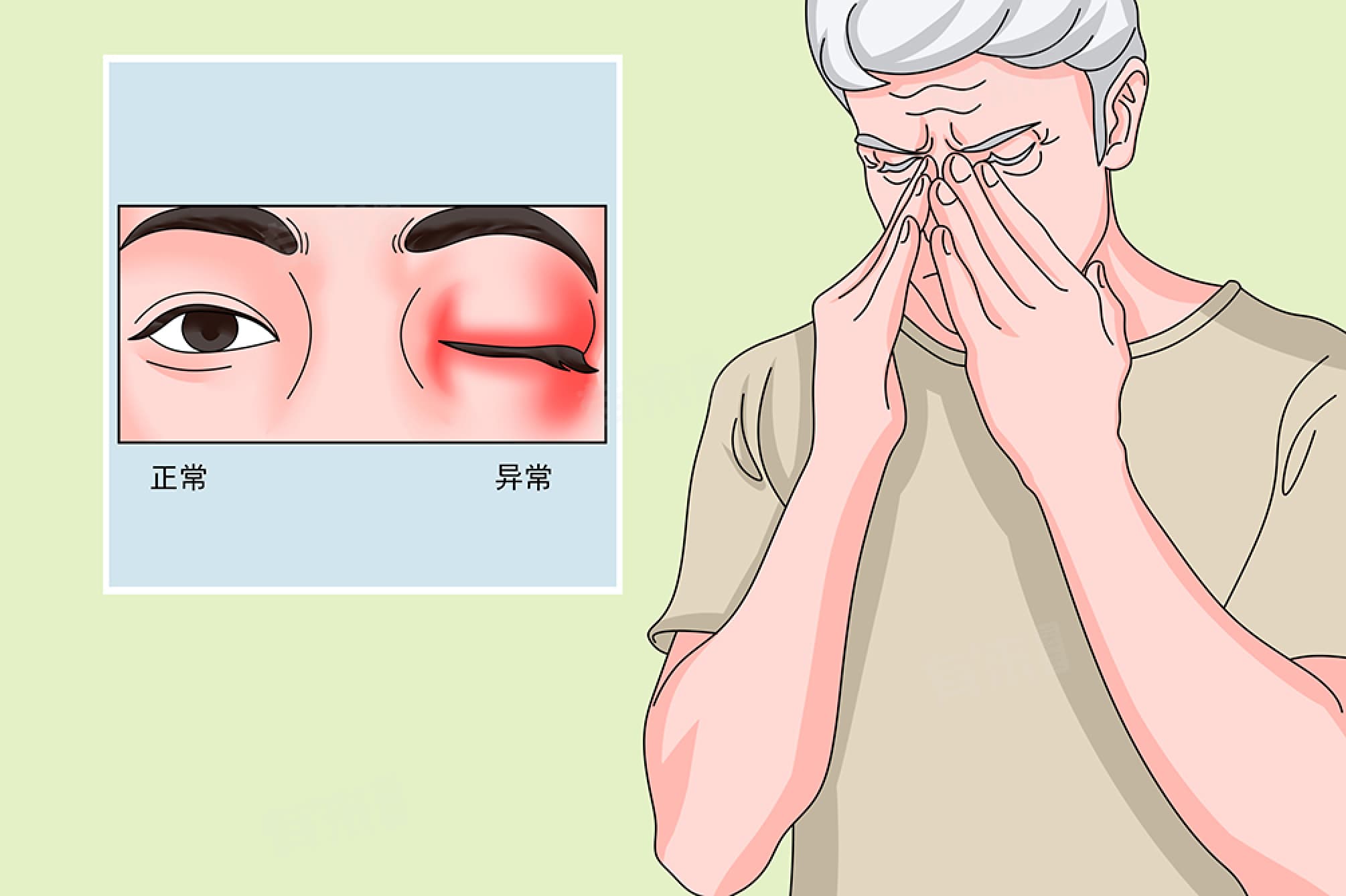 上眼皮浮肿下垂的原因及预防方法