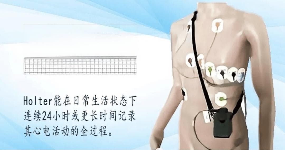 动态心电图监测——更懂你的“心”