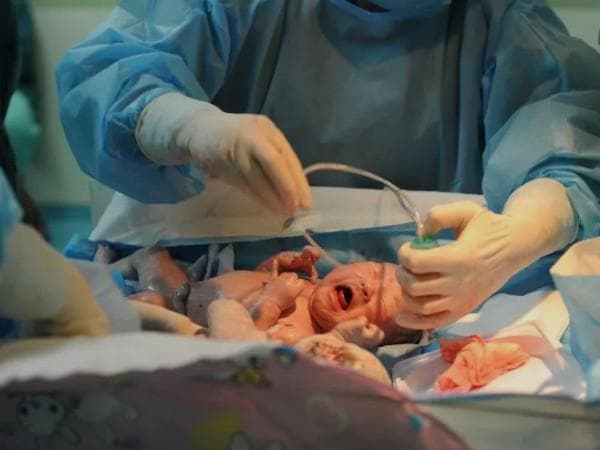 2024北医三院剖腹产费用清单及分娩攻略