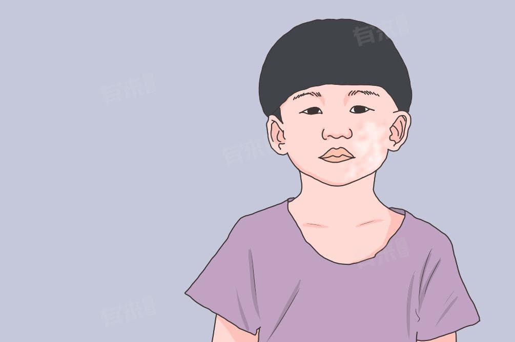 皮肤起白点是什么情况