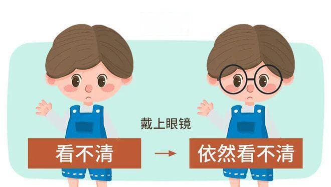 近视弱视要分清：及时治疗是关键
