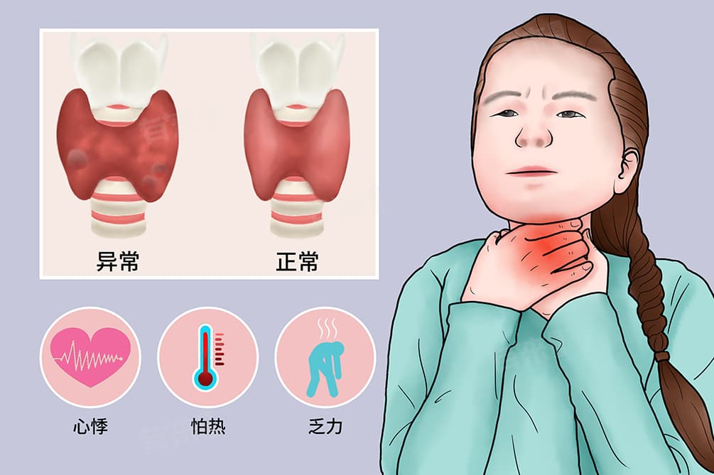 儿童甲亢症状表现有哪些