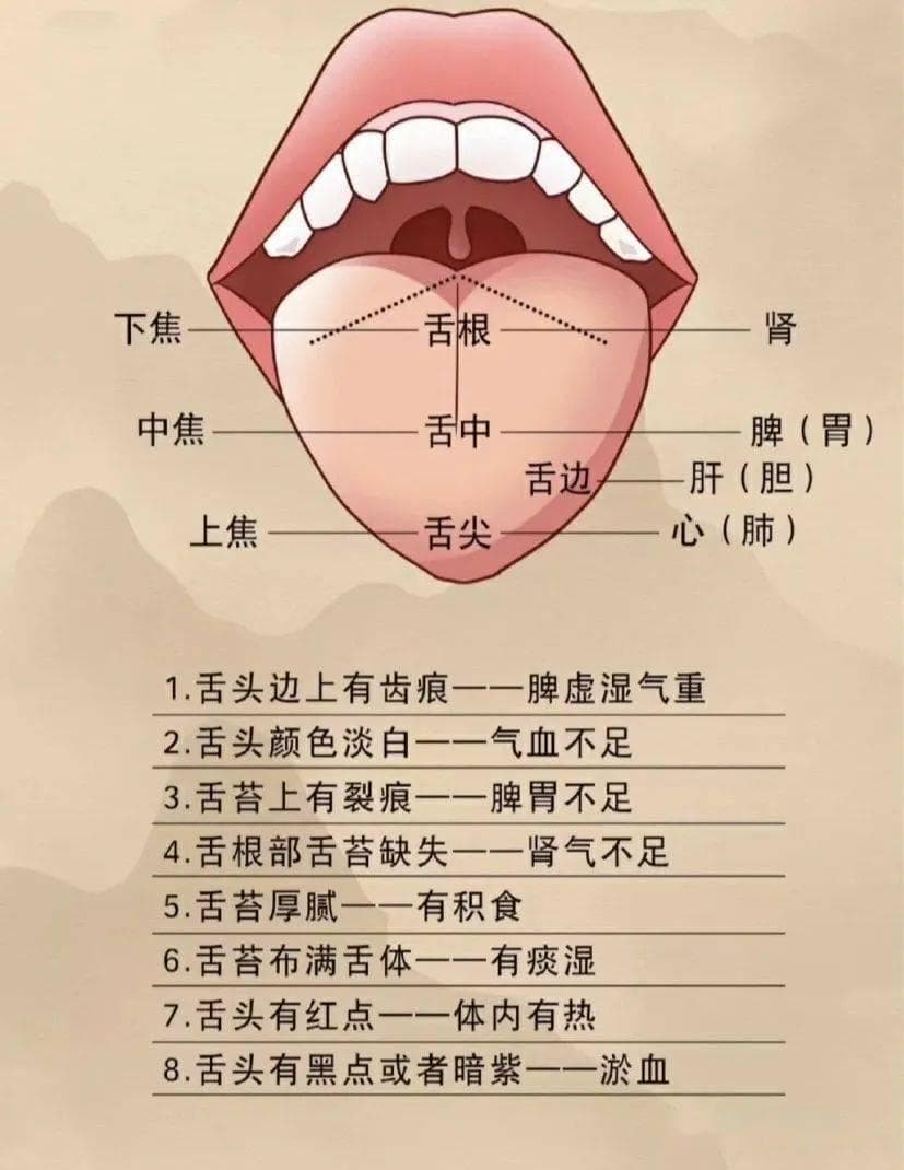 一张图带你看懂舌苔，7种常见舌像看看你是什么体质