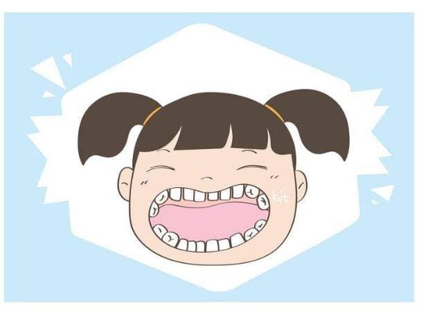孩子换牙如何防止长歪？这几点至关重要