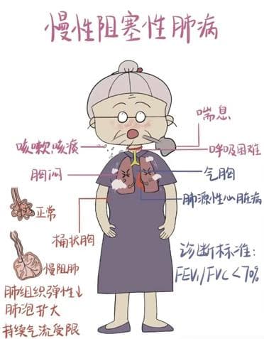长期咳嗽咳痰、呼吸困难？得去查查这个病