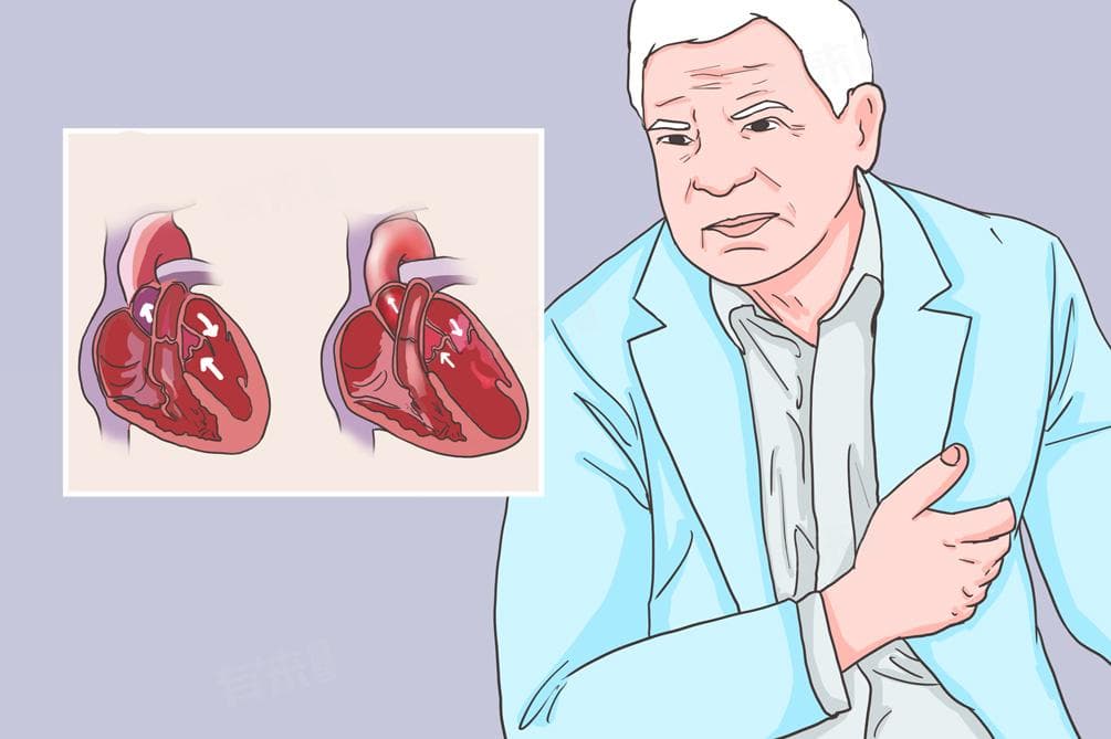 低压高是什么原因，低压100怎么解决