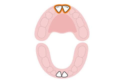小孩长两层牙齿是怎么回事？原因解析：多生牙、发育、遗传等各种因素都有可能！