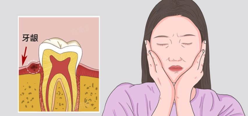 嘴里长了个肉疙瘩怎么办？可能的原因及预防方法