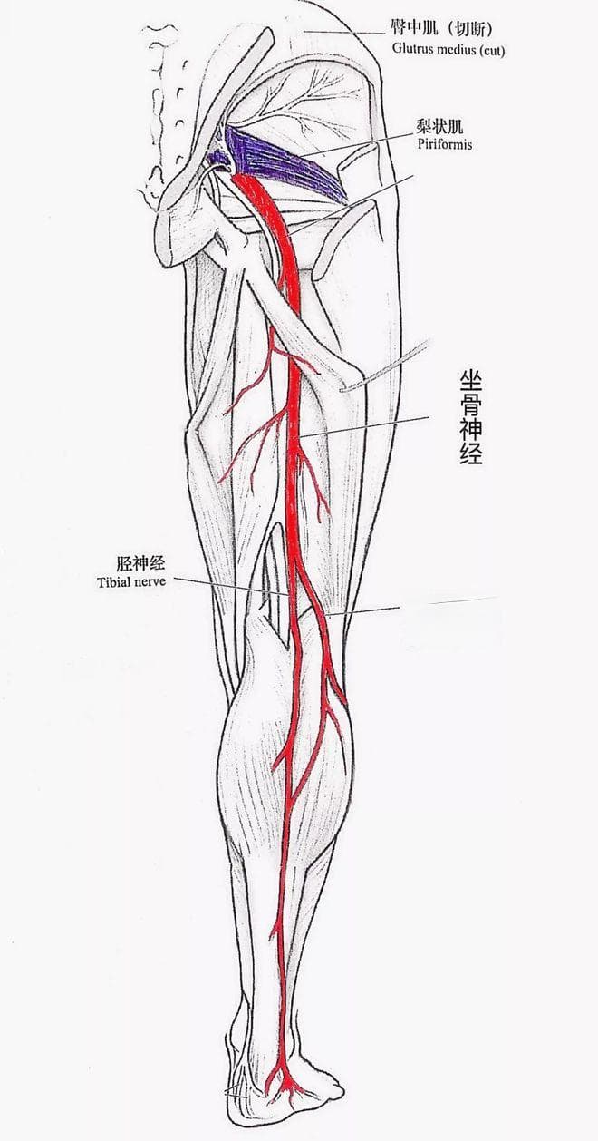 坐骨神经痛的5大原因总结！推荐12组功能训练~