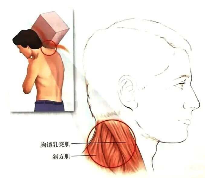 7种引起颈部和上肢神经疼痛的疾病，你知道多少？
