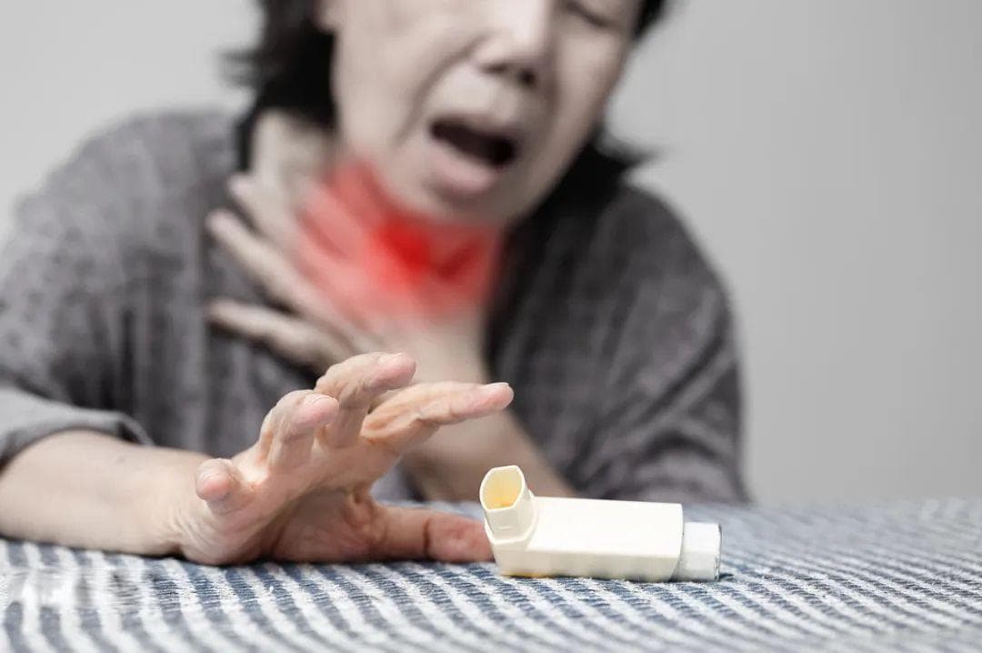 请注意！咳喘不是咳嗽！千万别忽视
