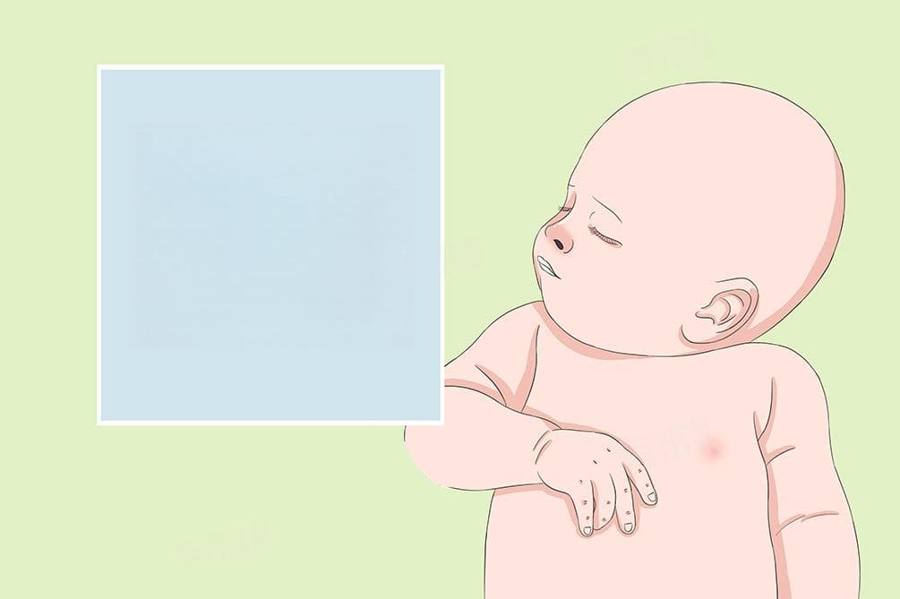 婴幼儿白血病的早期症状有哪些