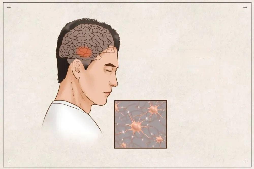 如何帮助癫痫患者走出心理阴霾？