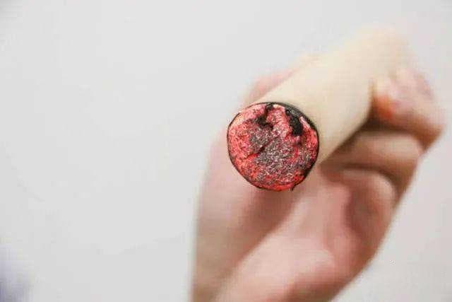 盲目艾灸不可取！艾灸的禁忌与注意事项