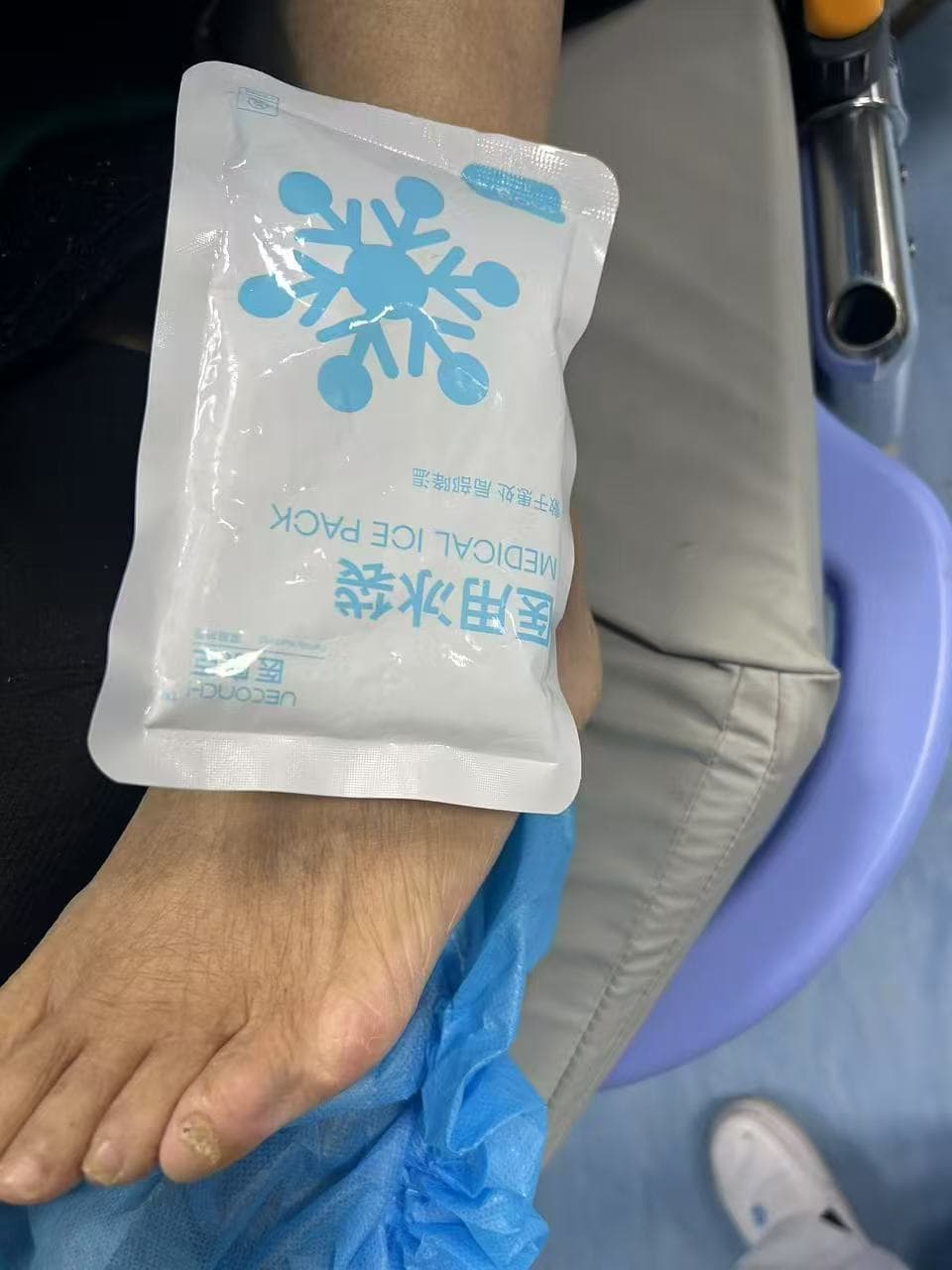 脚扭伤怎么办？三六三医院急诊科专业科普