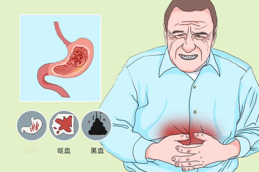 胃萎缩性胃炎伴糜烂：病因、预防与治疗全解析