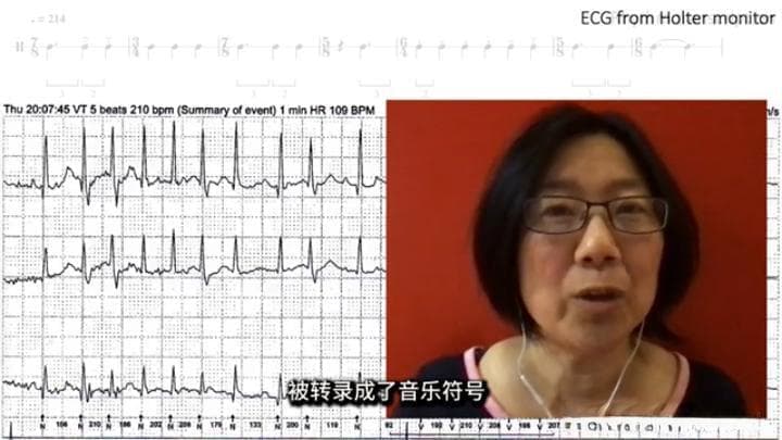 音乐与心跳的共鸣：探索心房颤动与音乐的奇妙联系