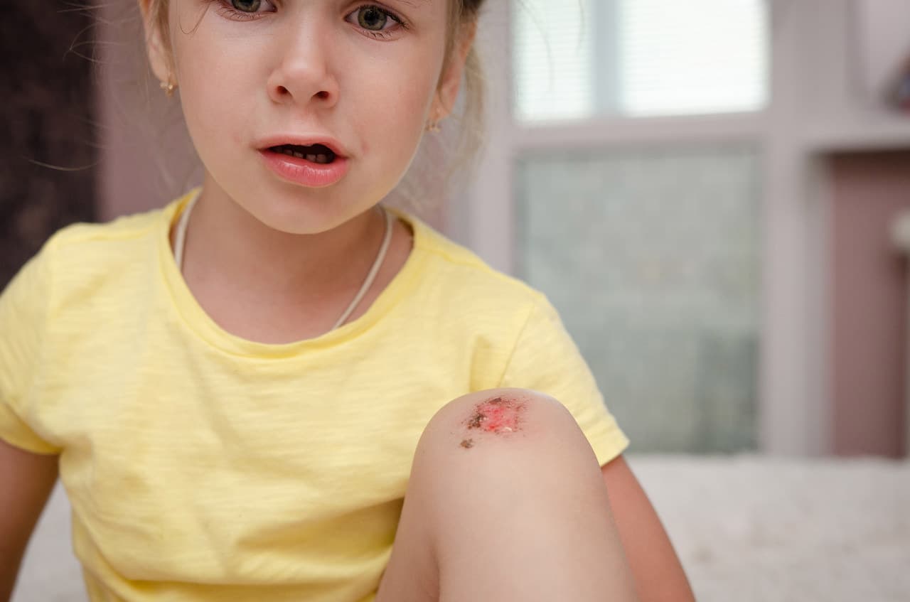 小孩脸擦伤了涂什么药好得快一点