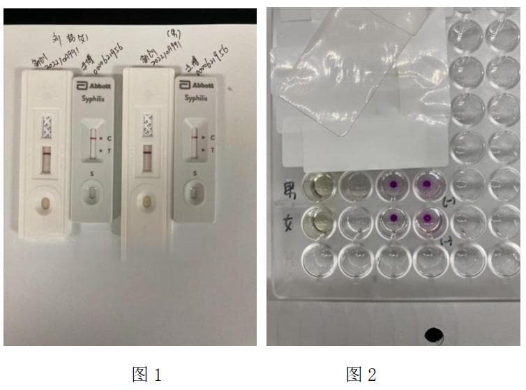 新冠感染后梅毒血清学检测假阳性情况调查