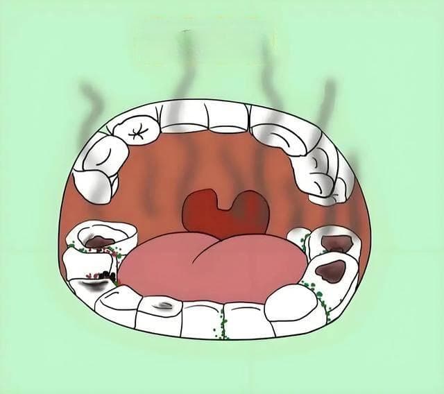名老中医秦伯未：揭秘口中异味用药经验