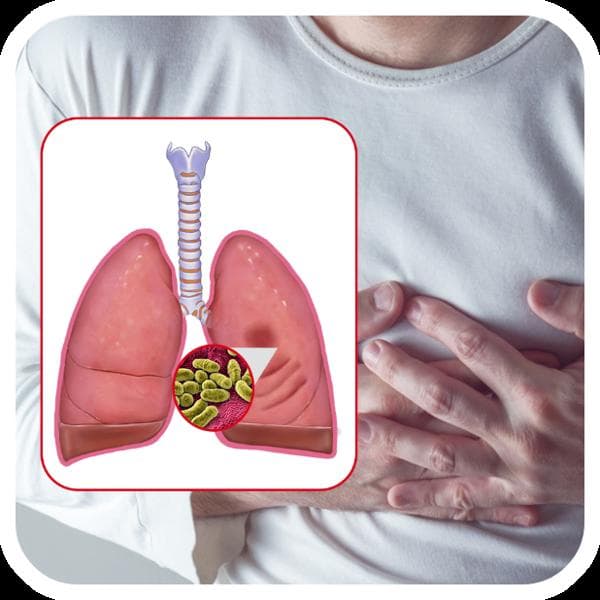 胸膜炎用什么药治疗最好