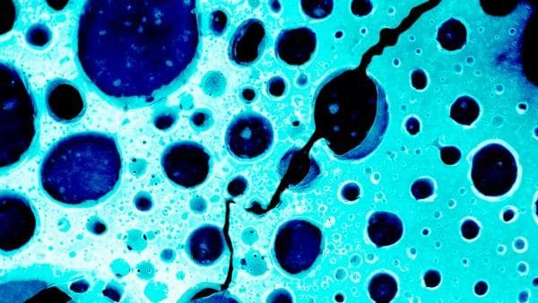 德国科学家发现：癌细胞本身能生产毁灭自己的“药物”