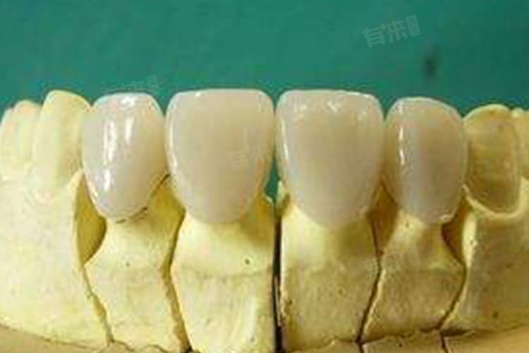 钴铬烤瓷牙可以做磁共振吗？这些风险要知道