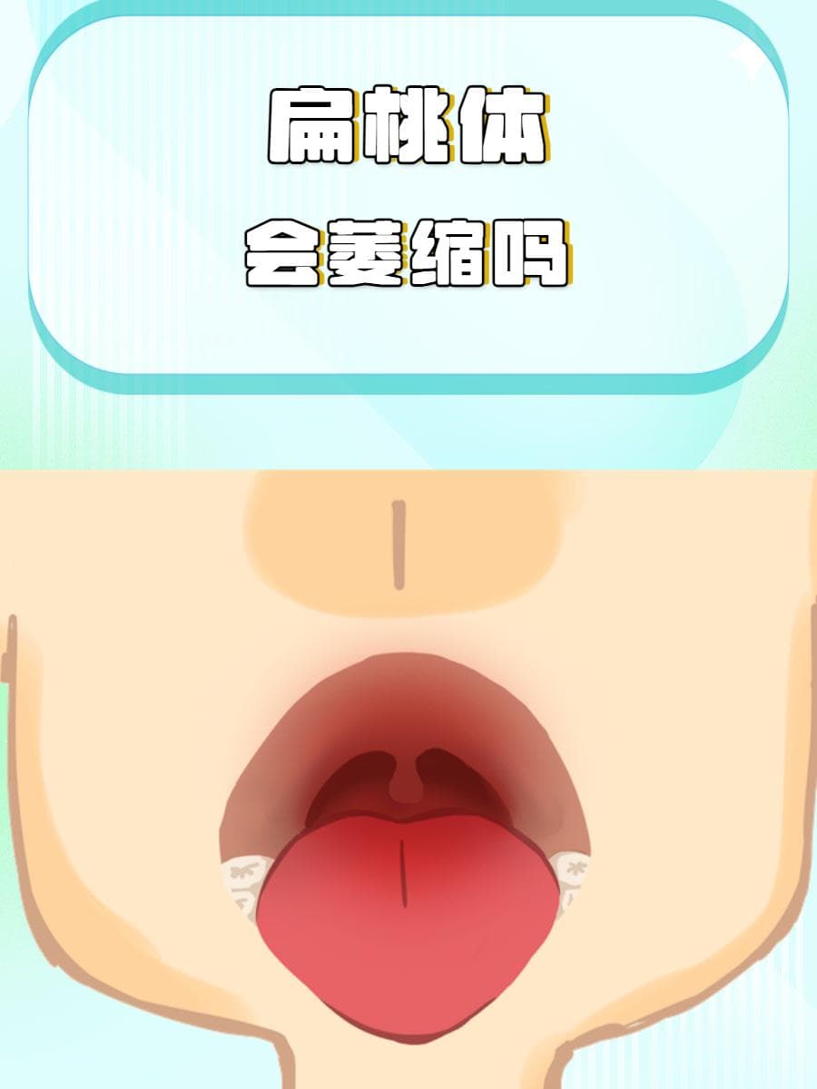 扁桃体会萎缩吗？解析扁桃体萎缩的真相