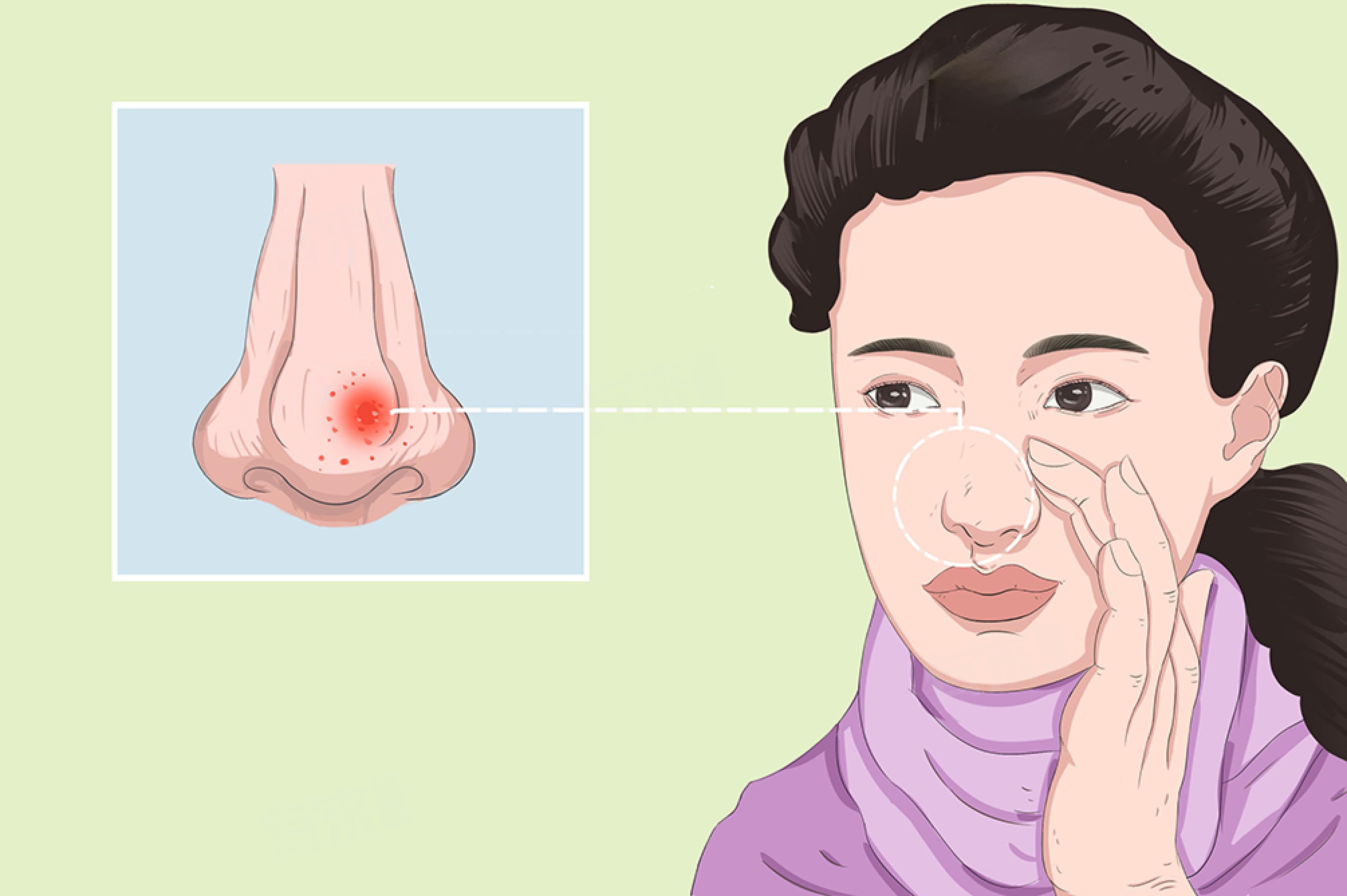 鼻子挂号挂什么科