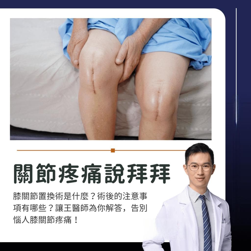 人工膝关节置换术后恢复期多久？康复怎么做？看懂术后注意事项
