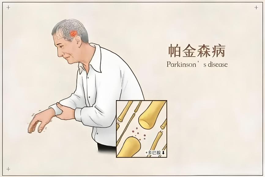 帕金森患者宜居环境指南，温馨舒适助康复