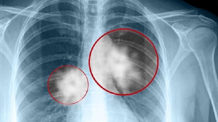 医院体检项目及费用全解析：如何选择适合自己的体检方案