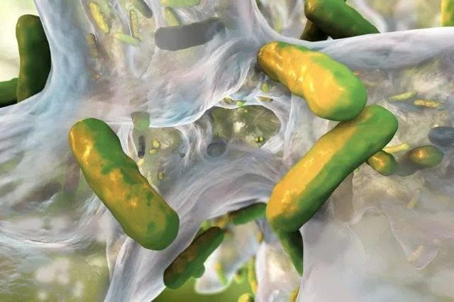 减轻肺部感染，从肠道菌群入手！徐金富团队揭示支气管扩张症的“肠-肺轴”机制