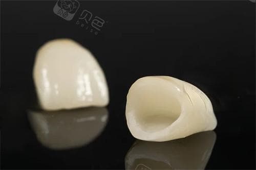 种前牙选国产牙冠还是进口牙冠好？各有优势，国产牙冠价格低|进口牙冠适用广泛