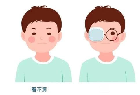家长们容易忽视掉孩子的这个视力问题