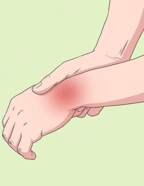 手腕扭伤要怎样才能快速恢复