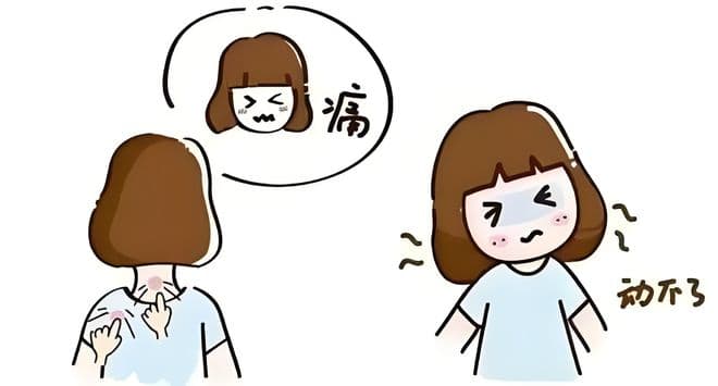 肩痛怎么办？先分清是肩周炎还是肩袖损伤再说！