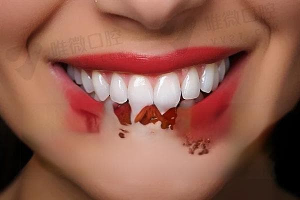 根管治疗是否每次都会感到疼痛？了解治疗过程中的疼痛情况与应对方法