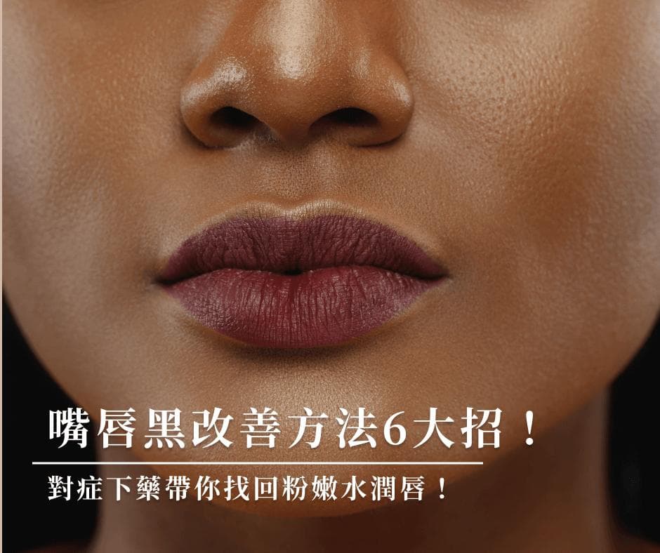 嘴唇黑改善方法6大招！对症下药带你找回粉嫩水润唇！
